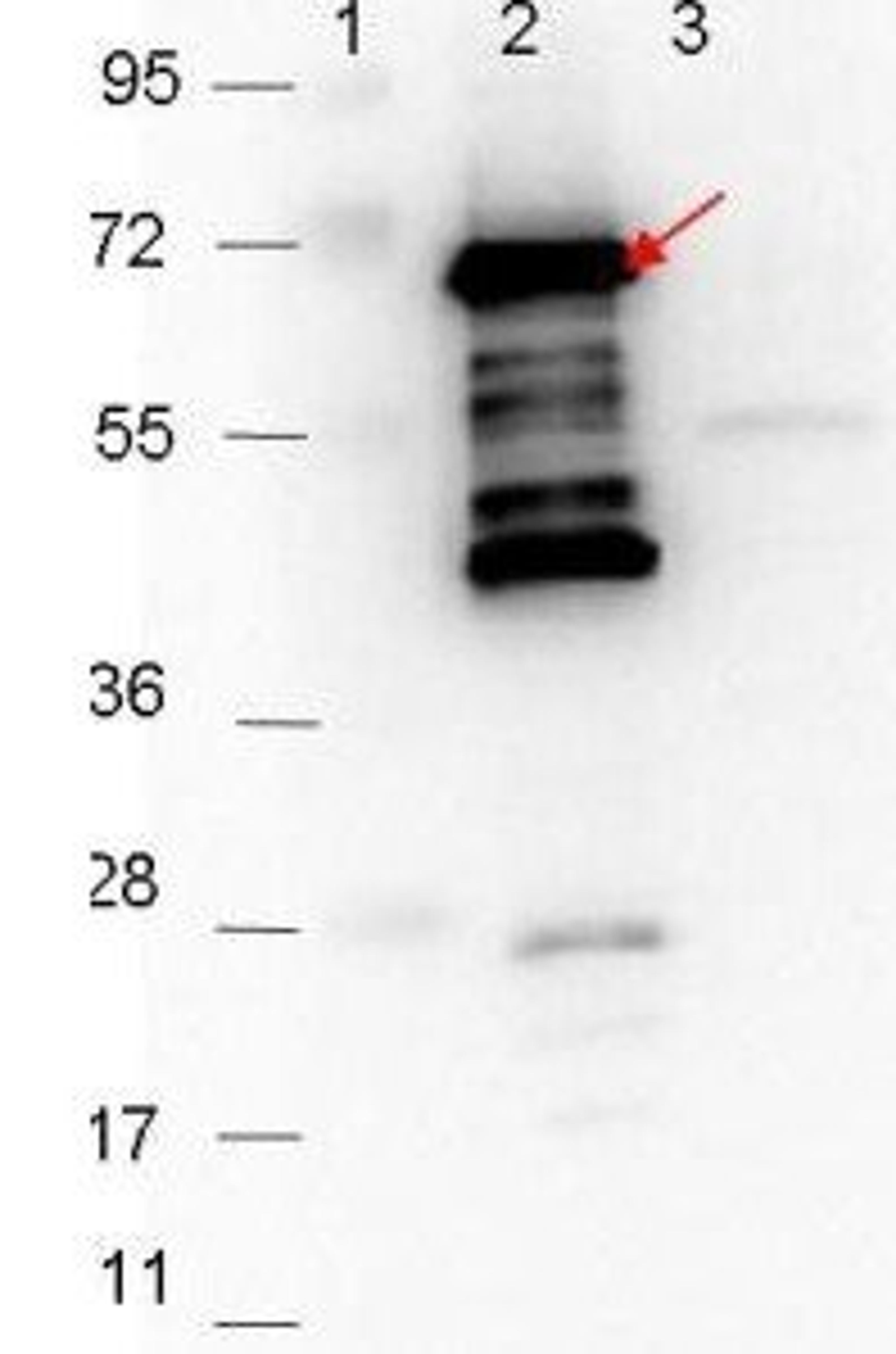 Western blot analysis of Lane 1: Molecular weight markers. Lane 2: MBP-p35 fusion protein (arrow; expected MW: 69.5 kDa). Lane 3: MBP alone using p35 antibody