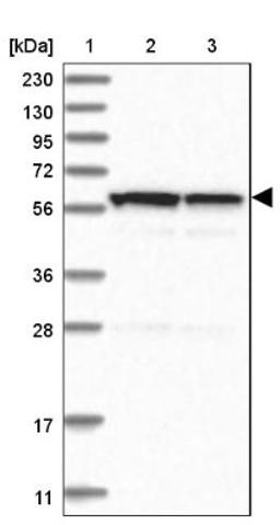 Western Blot: C6orf118 Antibody [NBP1-88726] - Lane 1: Marker [kDa] 230, 130, 95, 72, 56, 36, 28, 17, 11<br/>Lane 2: Human cell line RT-4<br/>Lane 3: Human cell line U-251MG sp