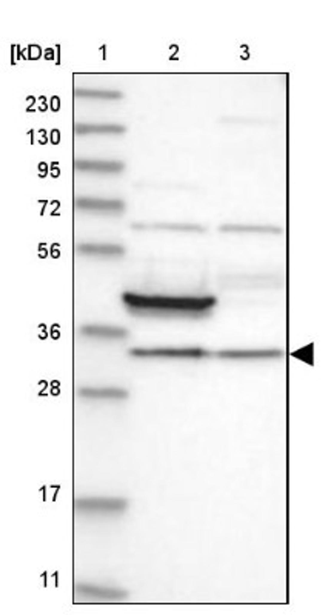 Western Blot: FAM189A2 Antibody [NBP1-86698] - Lane 1: Marker [kDa] 230, 130, 95, 72, 56, 36, 28, 17, 11<br/>Lane 2: Human cell line RT-4<br/>Lane 3: Human cell line U-251MG sp