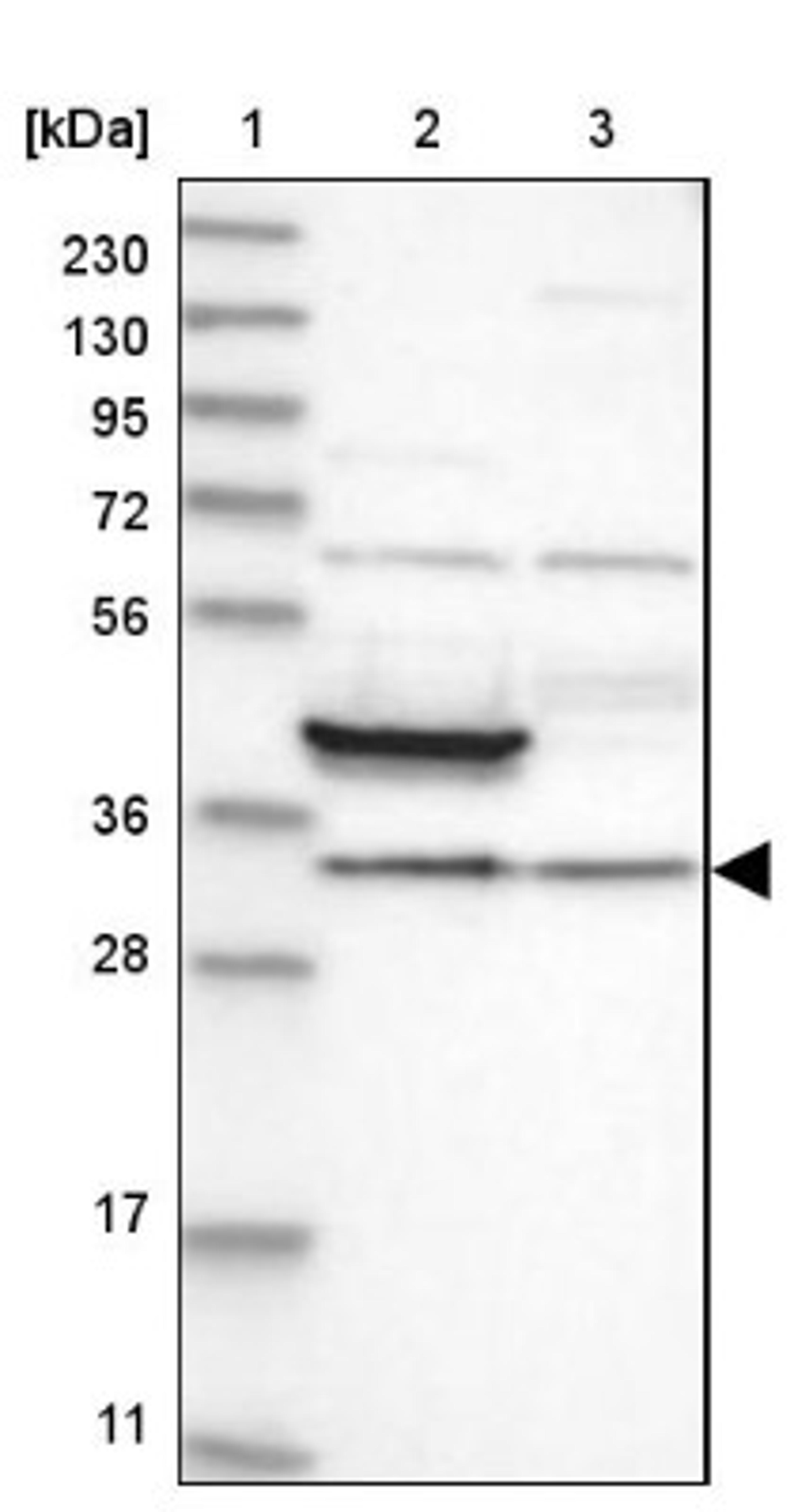 Western Blot: FAM189A2 Antibody [NBP1-86698] - Lane 1: Marker [kDa] 230, 130, 95, 72, 56, 36, 28, 17, 11<br/>Lane 2: Human cell line RT-4<br/>Lane 3: Human cell line U-251MG sp