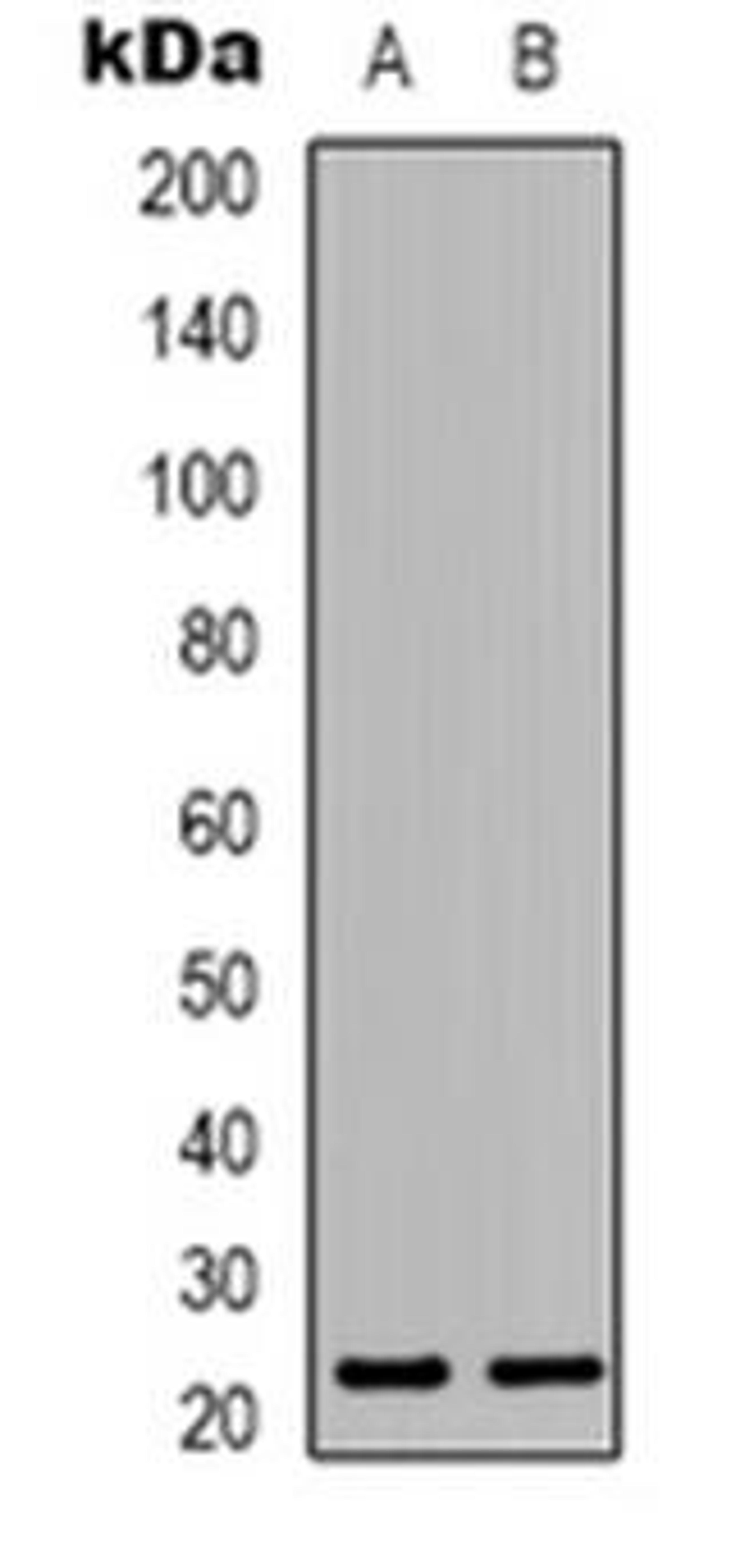 Western blot analysis of MRPL22 expression in Hela (Lane 1), HepG2 (Lane 2) whole cell lysates using MRPL22 antibody