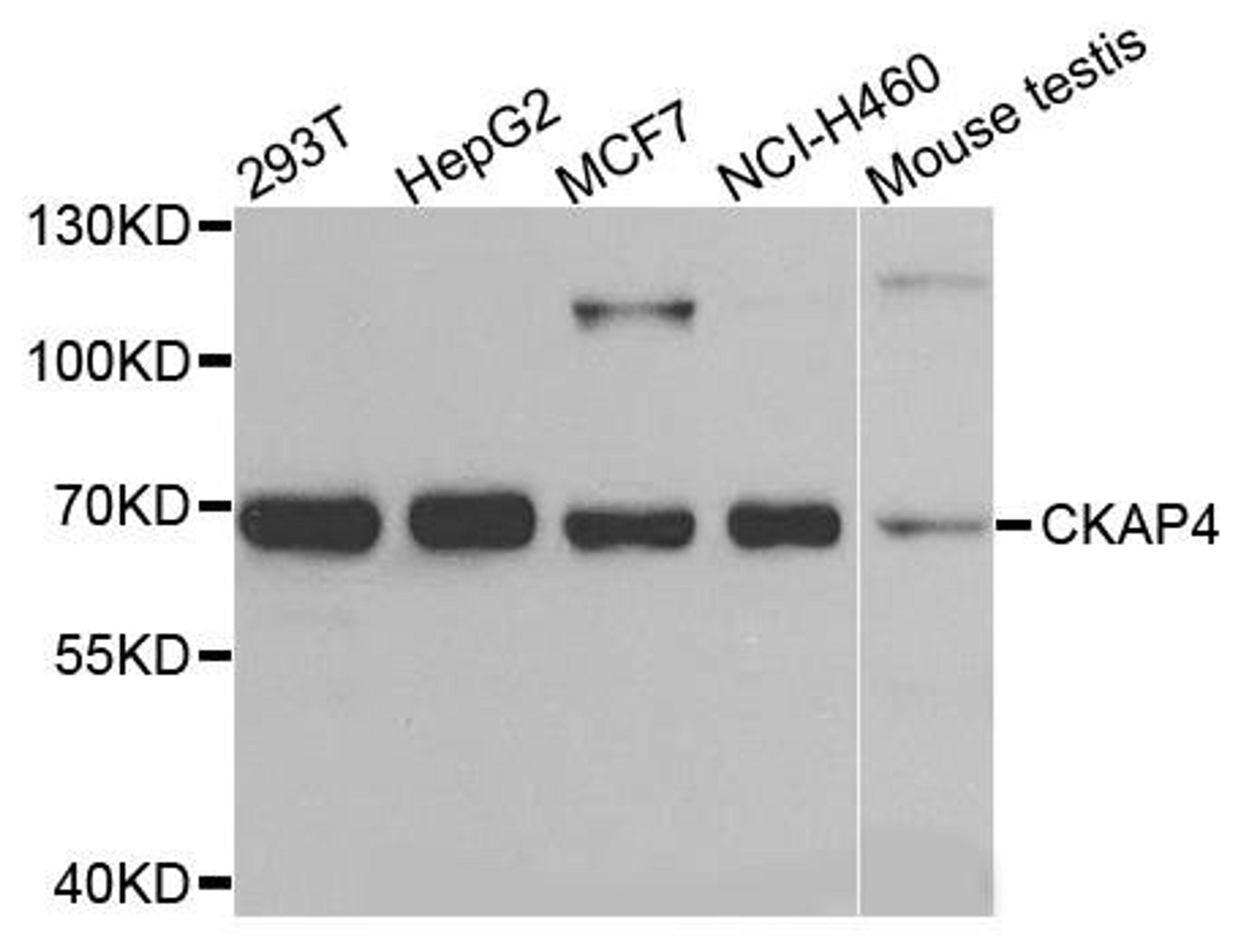 Western blot analysis of extracts of various cells using CKAP4 antibody