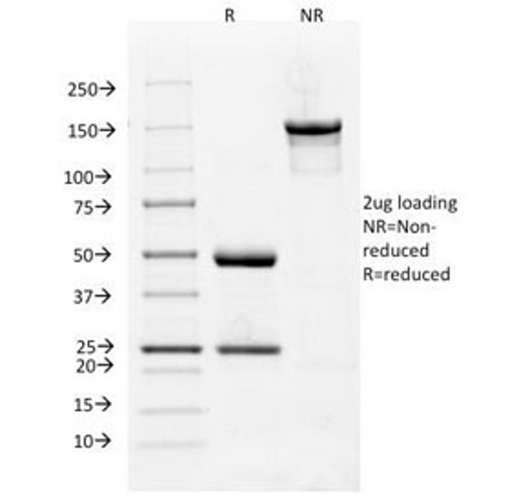 SDS-PAGE Analysis of Purified, BSA-Free VEGFR1 Antibody (clone FLT1/658). Confirmation of Integrity and Purity of the Antibody.