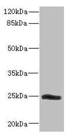 Western blot. All lanes: SNRPB2 antibody IgG at 2.26ug/ml + Mouse kidney tissue. Secondary. Goat polyclonal to rabbit IgG at 1/10000 dilution. Predicted band size: 25 kDa. Observed band size: 25 kDa. 