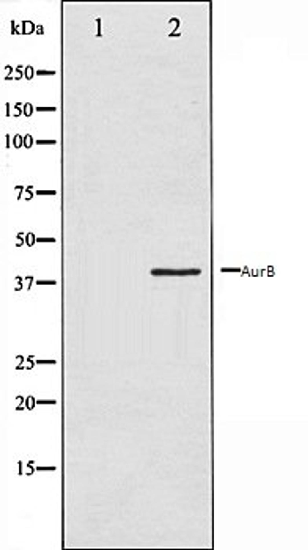 Western blot analysis of COS7 whole cell lysates using AurB antibody, The lane on the left is treated with the antigen-specific peptide.