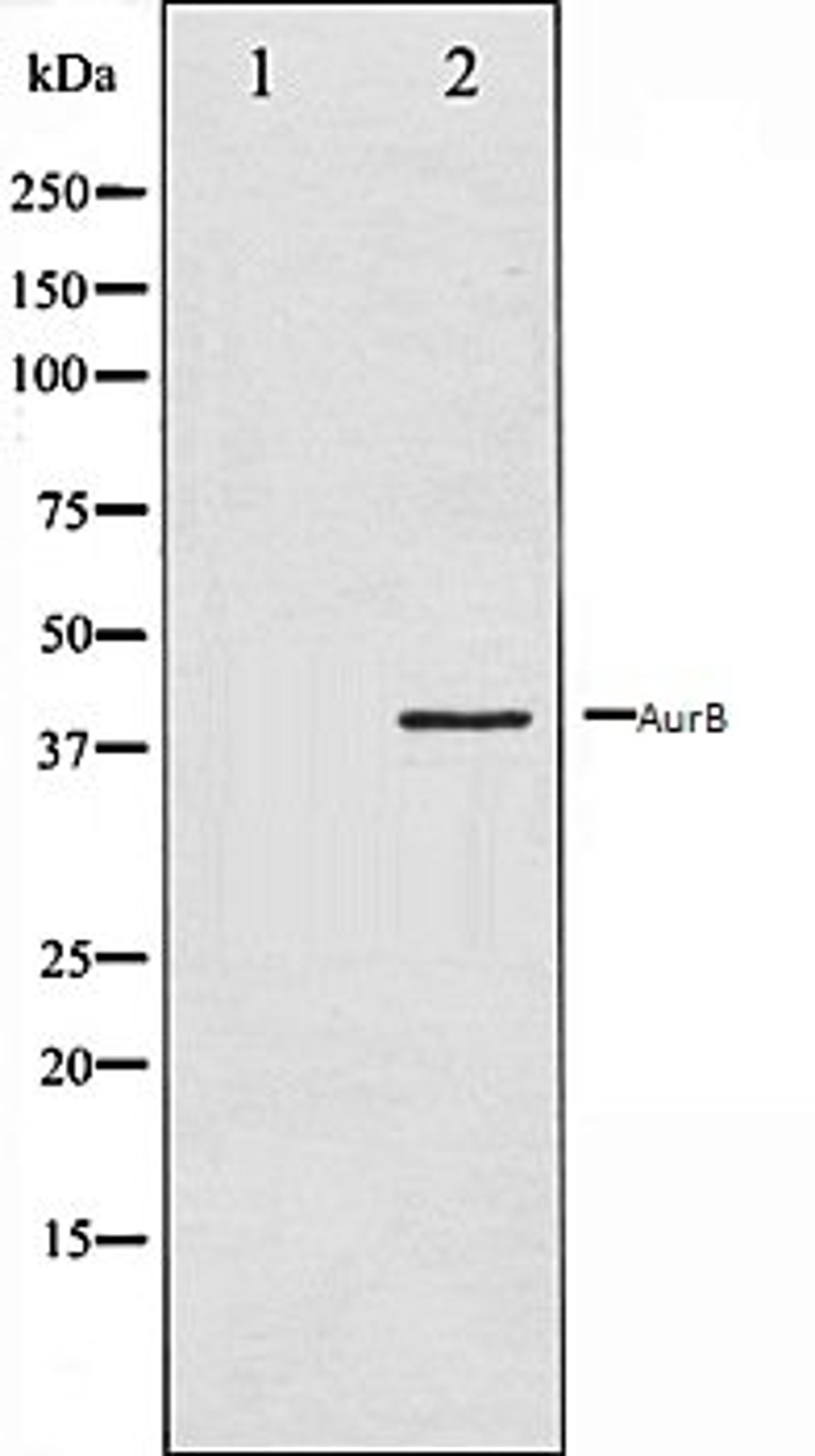 Western blot analysis of COS7 whole cell lysates using AurB antibody, The lane on the left is treated with the antigen-specific peptide.