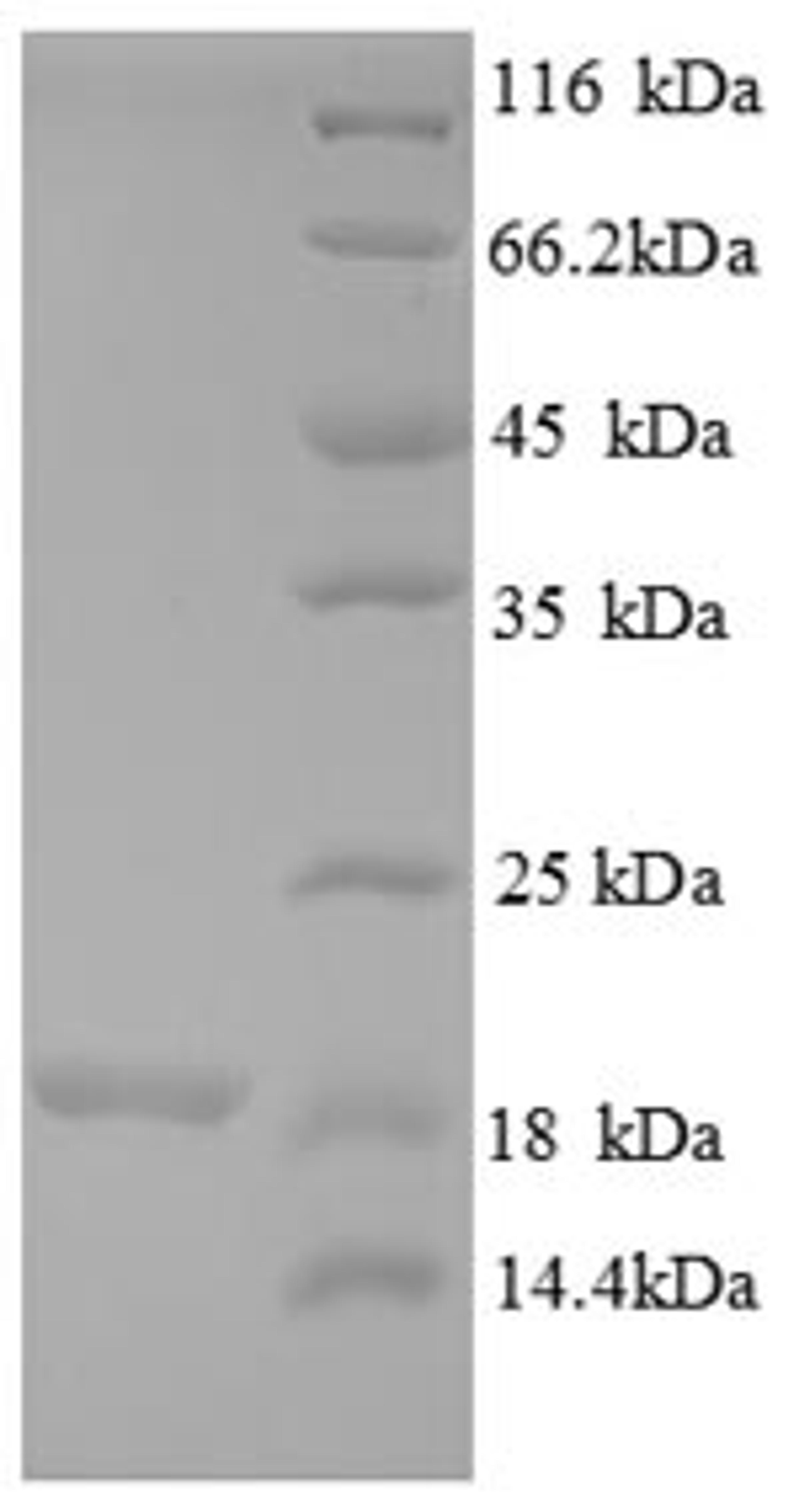 (Tris-Glycine gel) Discontinuous SDS-PAGE (reduced) with 5% enrichment gel and 15% separation gel.