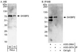 Detection of human SH3BP2 by western blot and immunoprecipitation.