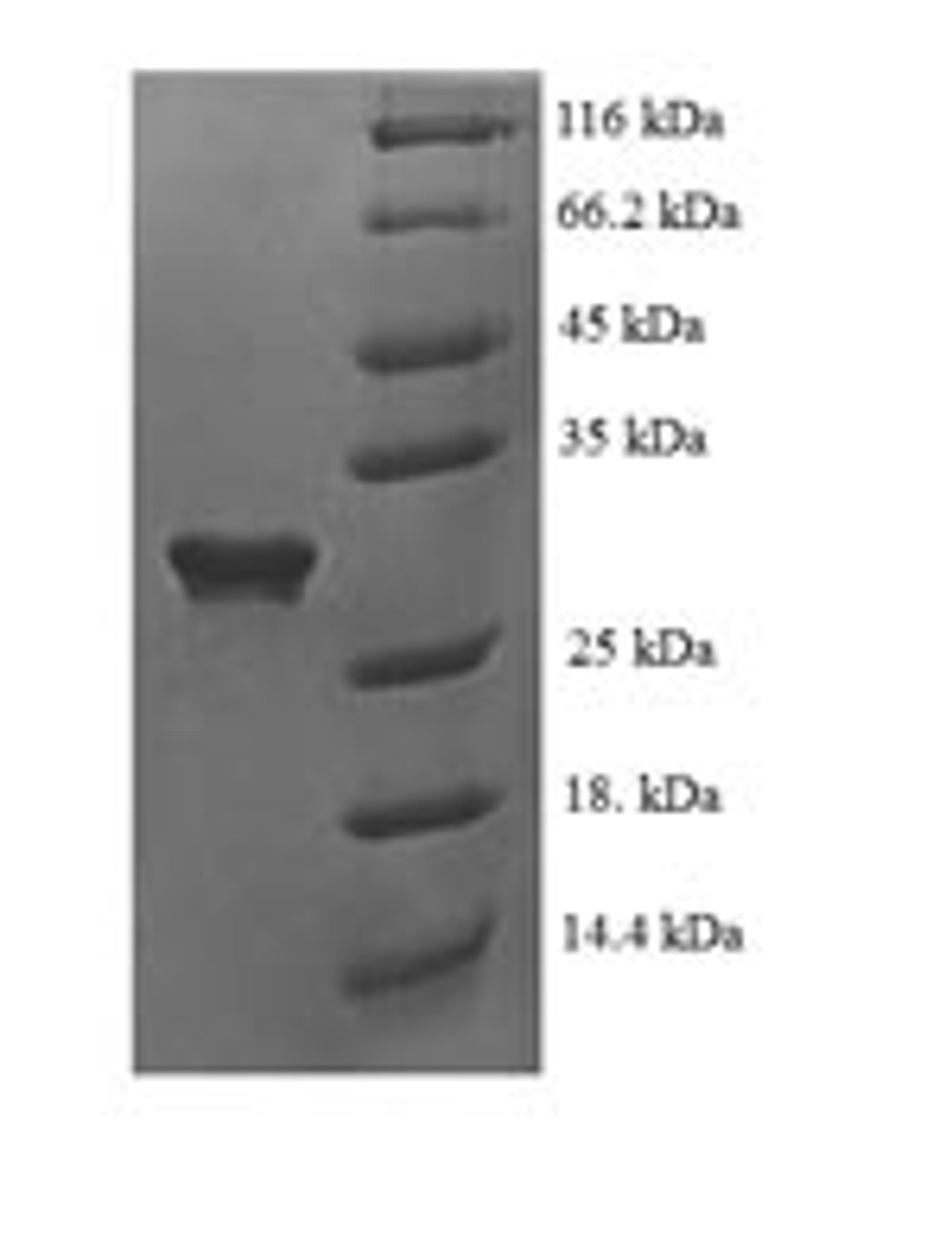 (Tris-Glycine gel) Discontinuous SDS-PAGE (reduced) with 5% enrichment gel and 15% separation gel.