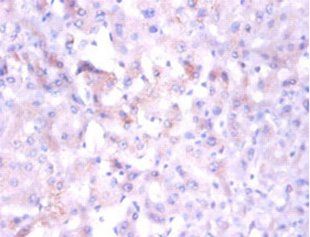 Immunohistochemistry of paraffin-embedded human liver tissue using CSB-PA01665A0Rb at dilution of 1:100