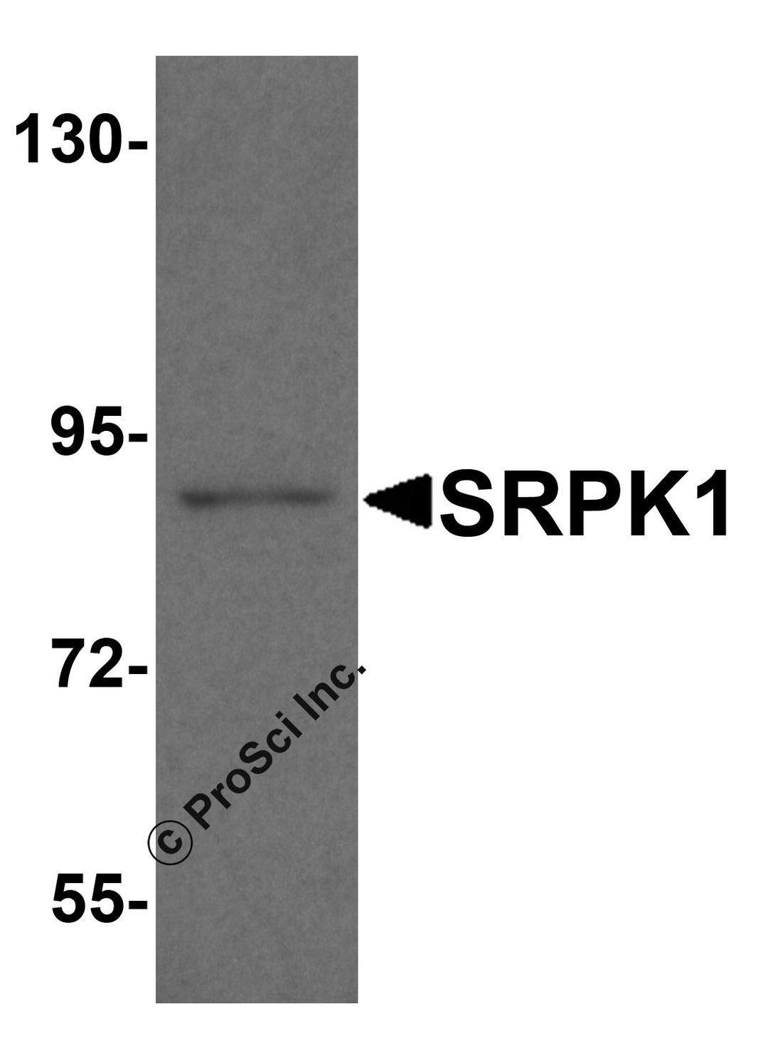 Western blot analysis of SRPK1 in mouse heart tissue lysate with SRPK1 antibody at 1 μg/ml.
