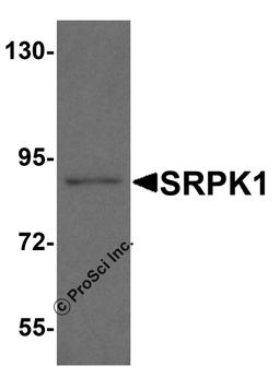 Western blot analysis of SRPK1 in mouse heart tissue lysate with SRPK1 antibody at 1 μg/ml.