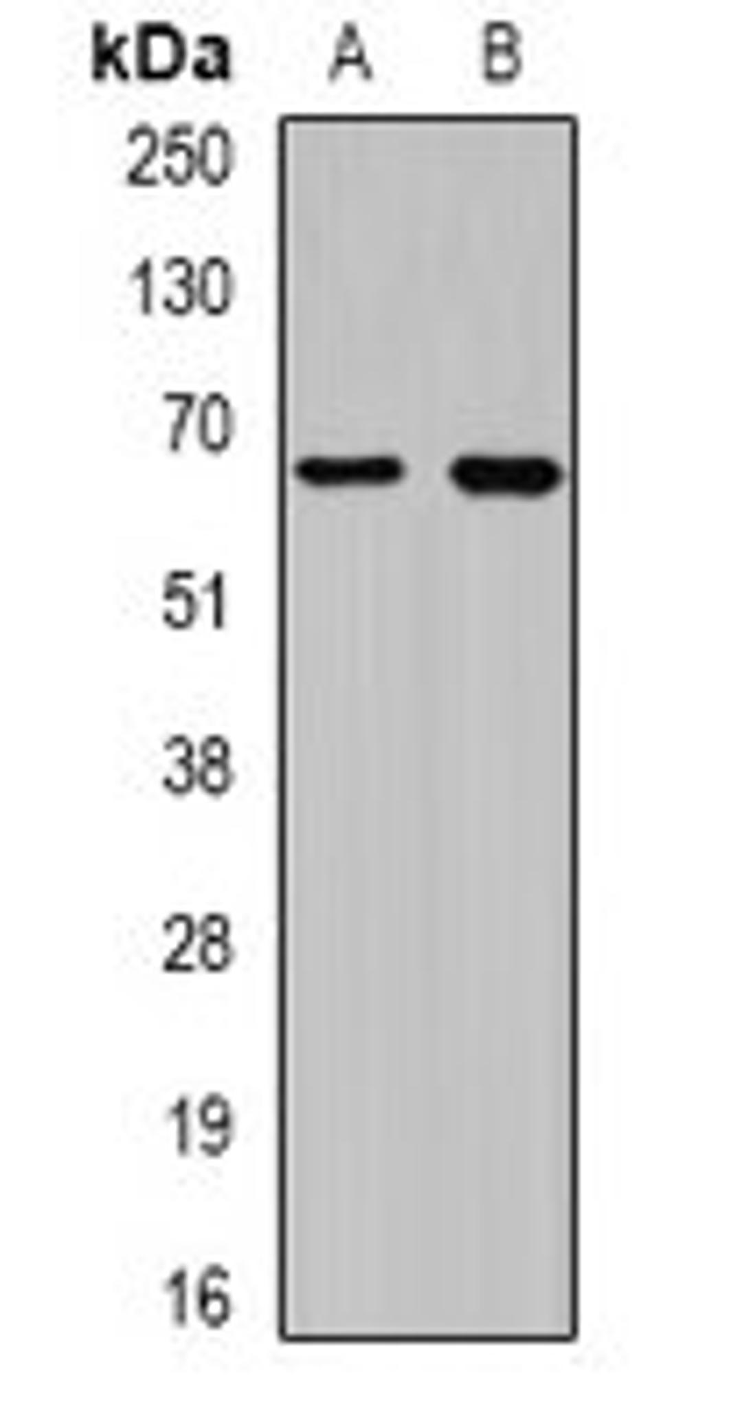 Western blot analysis of BT474 (Lane1), 22RV1 (Lane2) whole cell lysates using CEP57L1 antibody