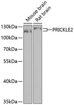 Western blot - PRICKLE2 antibody (A8023)