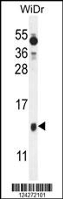 Western blot analysis in WiDr cell line lysates (35ug/lane).