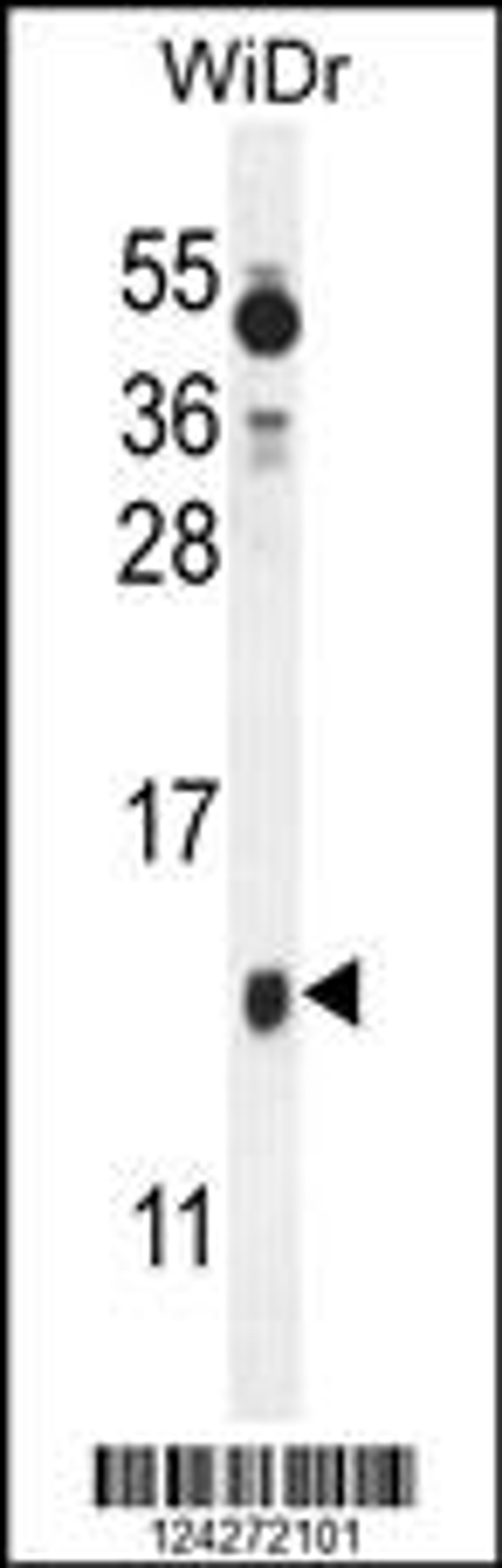 Western blot analysis in WiDr cell line lysates (35ug/lane).