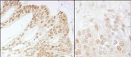 Detection of human and mouse CSN5 by immunohistochemistry.