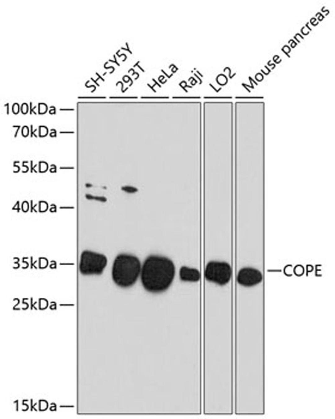 Western blot - COPE antibody (A10047)