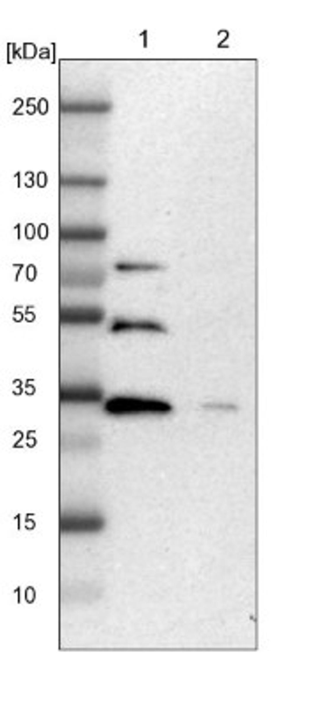 Western Blot: ZNF146 Antibody [NBP1-80968] - Lane 1: NIH-3T3 cell lysate (Mouse embryonic fibroblast cells)<br/>Lane 2: NBT-II cell lysate (Rat Wistar bladder tumour cells)