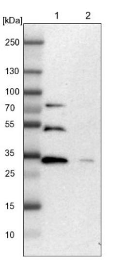 Western Blot: ZNF146 Antibody [NBP1-80968] - Lane 1: NIH-3T3 cell lysate (Mouse embryonic fibroblast cells)<br/>Lane 2: NBT-II cell lysate (Rat Wistar bladder tumour cells)