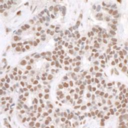 Detection of human RPA32 by immunohistochemistry.