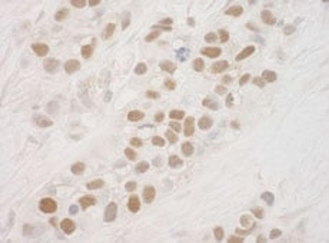 Detection of human MSK1 by immunohistochemistry.