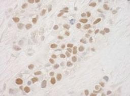 Detection of human MSK1 by immunohistochemistry.