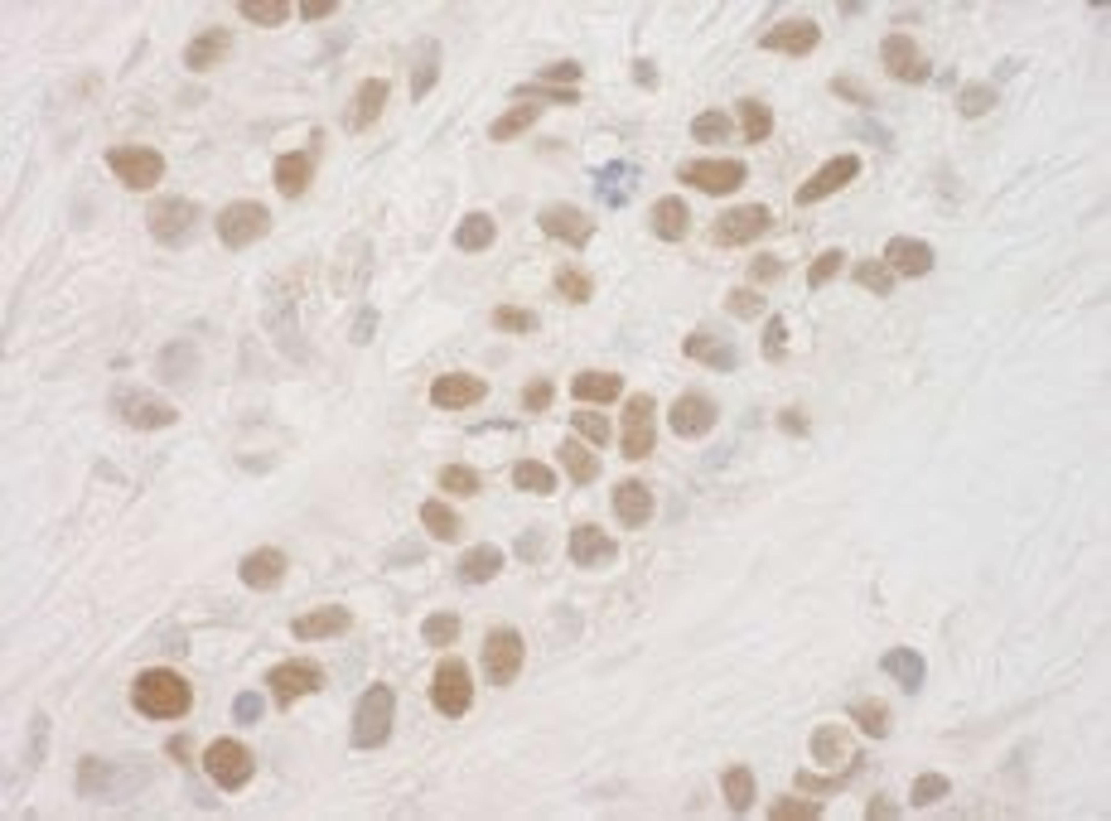 Detection of human MSK1 by immunohistochemistry.