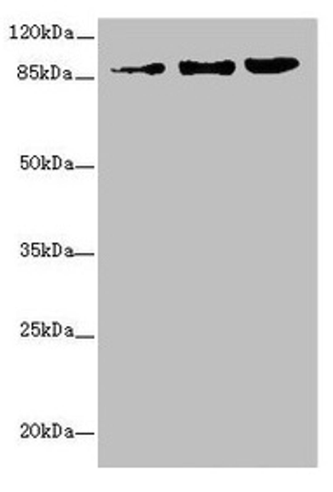 Western blot. All lanes: ZNF148 antibody at 1.06µg/ml. Lane 1: A375 whole cell lysate. Lane 2: HepG2 whole cell lysate. Lane 3: 293T whole cell lysate. Secondary. Goat polyclonal to rabbit IgG at 1/10000 dilution. Predicted band size: 89, 15 kDa. Observed band size: 89 kDa