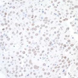 Detection of mouse BAF53A by immunohistochemistry.