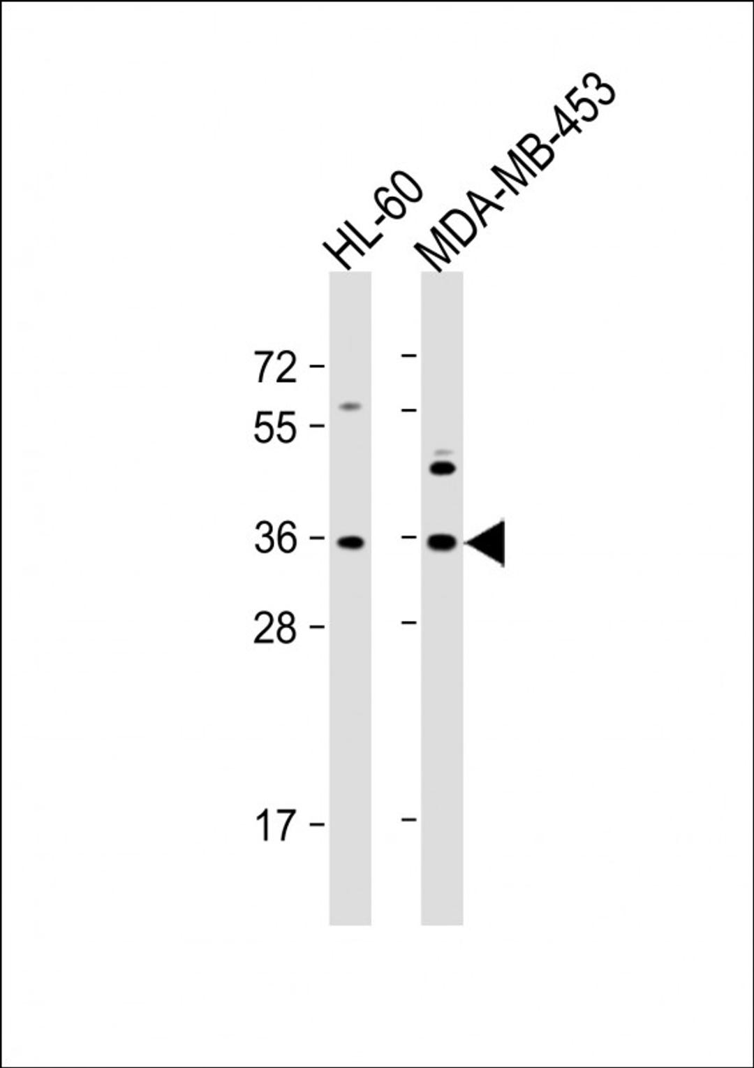 Western Blot at 1:1000 dilution Lane 1: HL-60 whole cell lysate Lane 2: MDA-MB-453 whole cell lysate Lysates/proteins at 20 ug per lane.