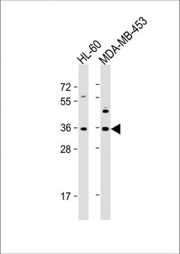 Western Blot at 1:1000 dilution Lane 1: HL-60 whole cell lysate Lane 2: MDA-MB-453 whole cell lysate Lysates/proteins at 20 ug per lane.