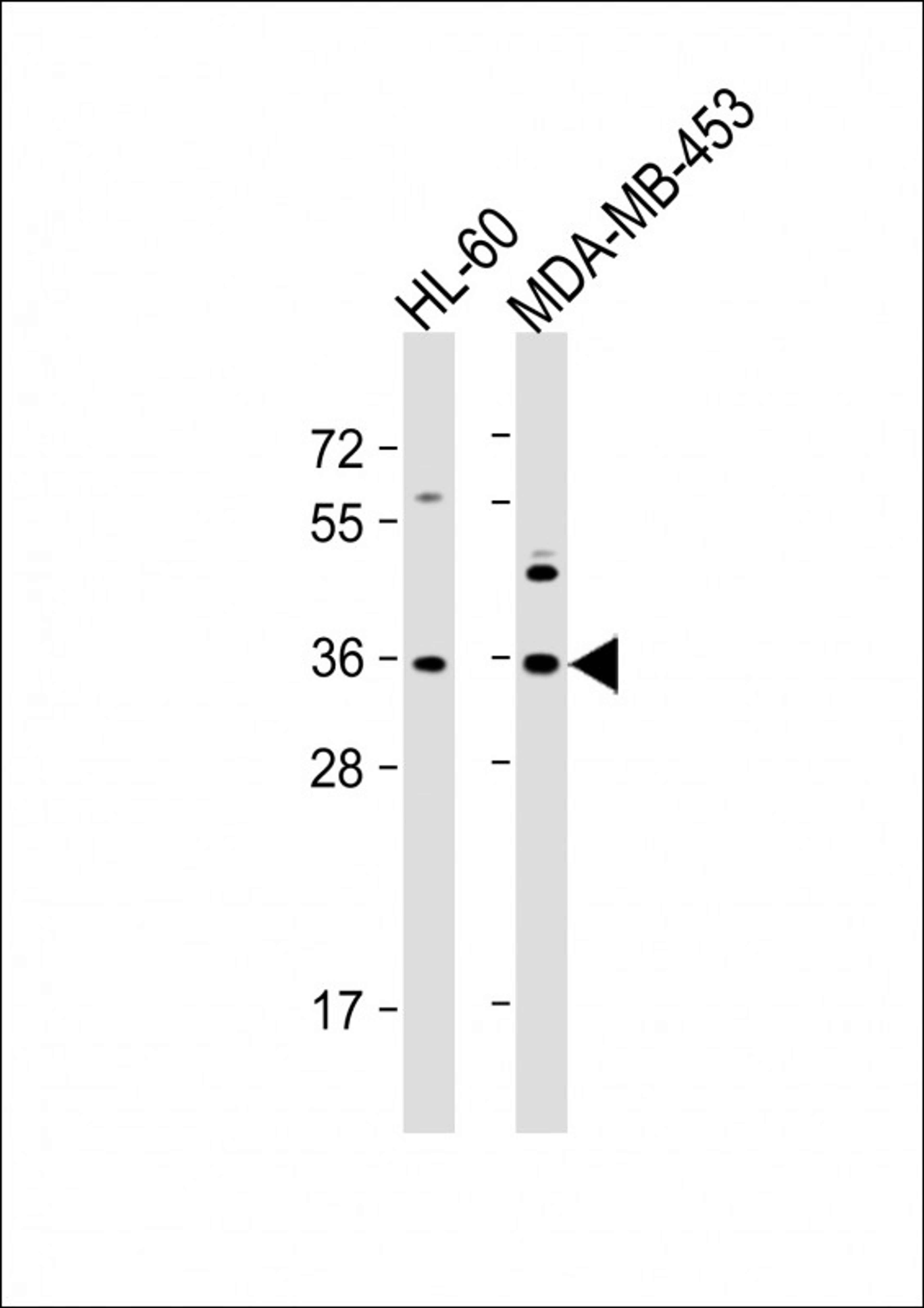 Western Blot at 1:1000 dilution Lane 1: HL-60 whole cell lysate Lane 2: MDA-MB-453 whole cell lysate Lysates/proteins at 20 ug per lane.