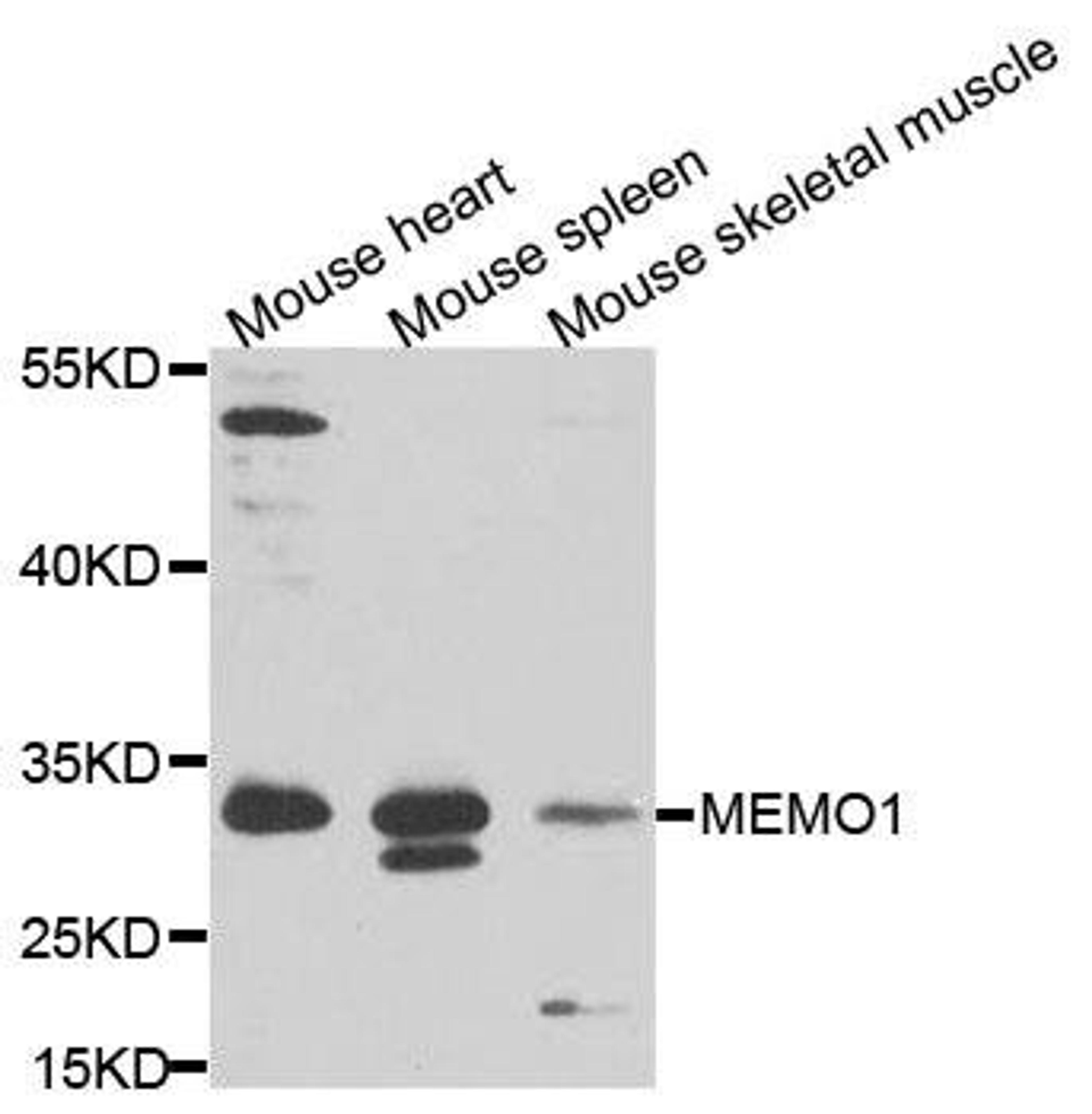 Western blot analysis of extracts of various cells using MEMO1 antibody