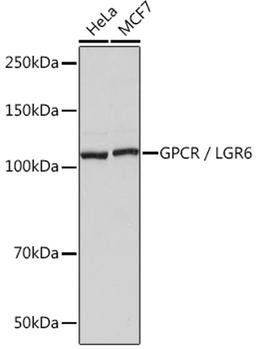 Western blot - GPCR / LGR6 Rabbit mAb (A9128)