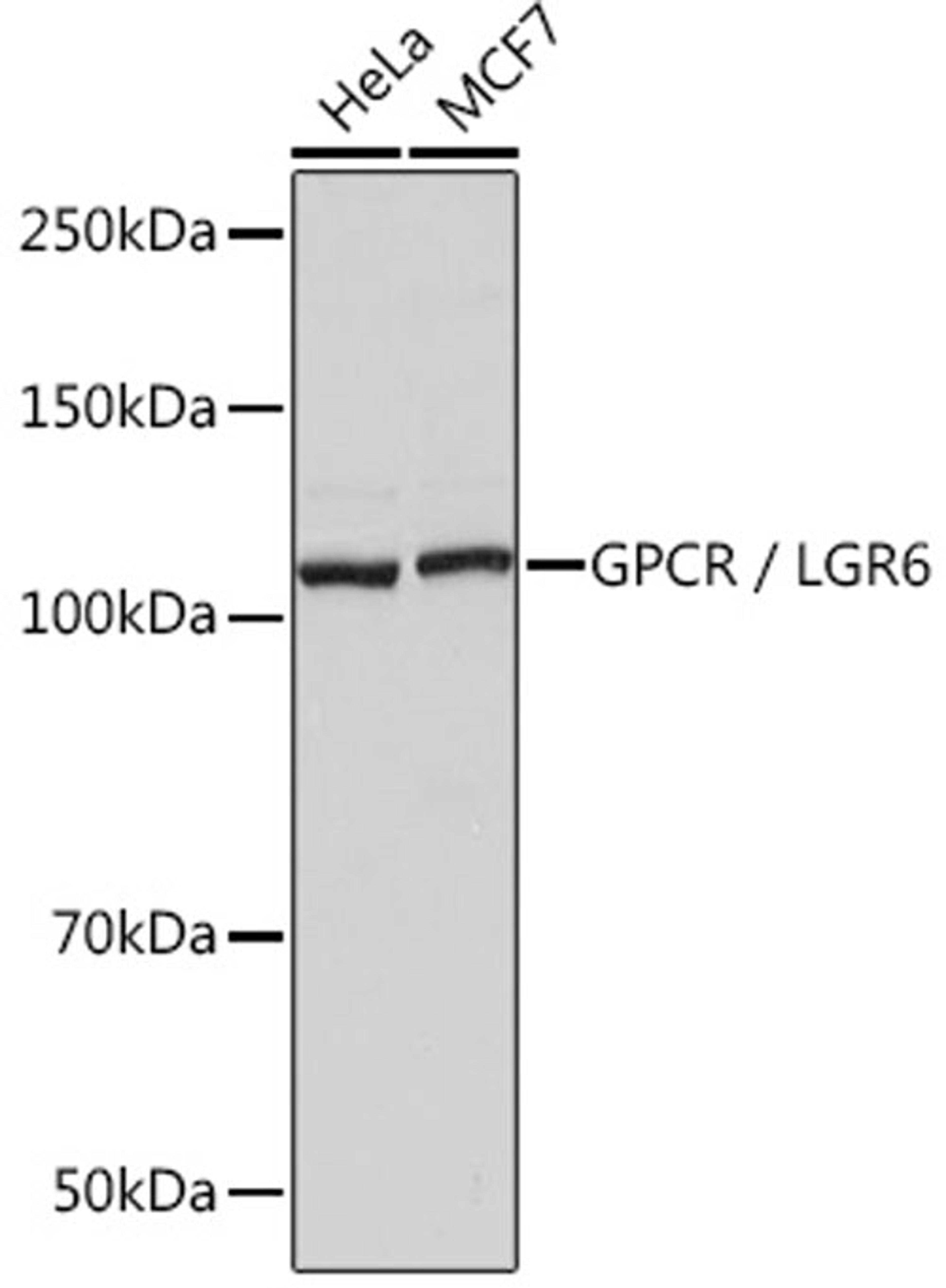 Western blot - GPCR / LGR6 Rabbit mAb (A9128)