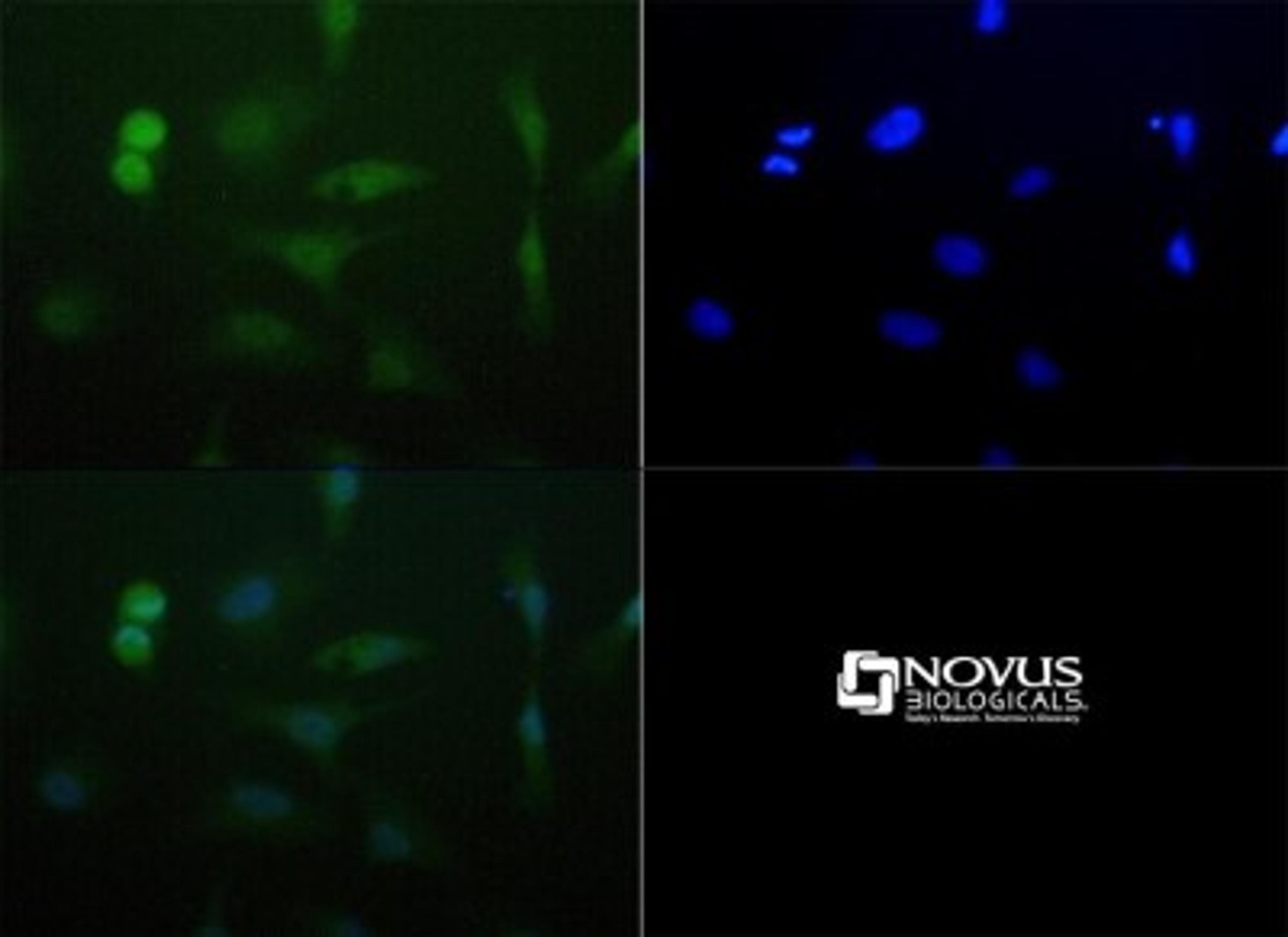 Immunocytochemistry/Immunofluorescence: Lysine (K)-specific Demethylase 4C/KDM4C/JMJD2C Antibody [NBP1-49600] - Antibody was tested at 1:50 in HeLa cells with Dylight 488 (green). Nuclei (Blue) were counterstained with DAPI (blue).