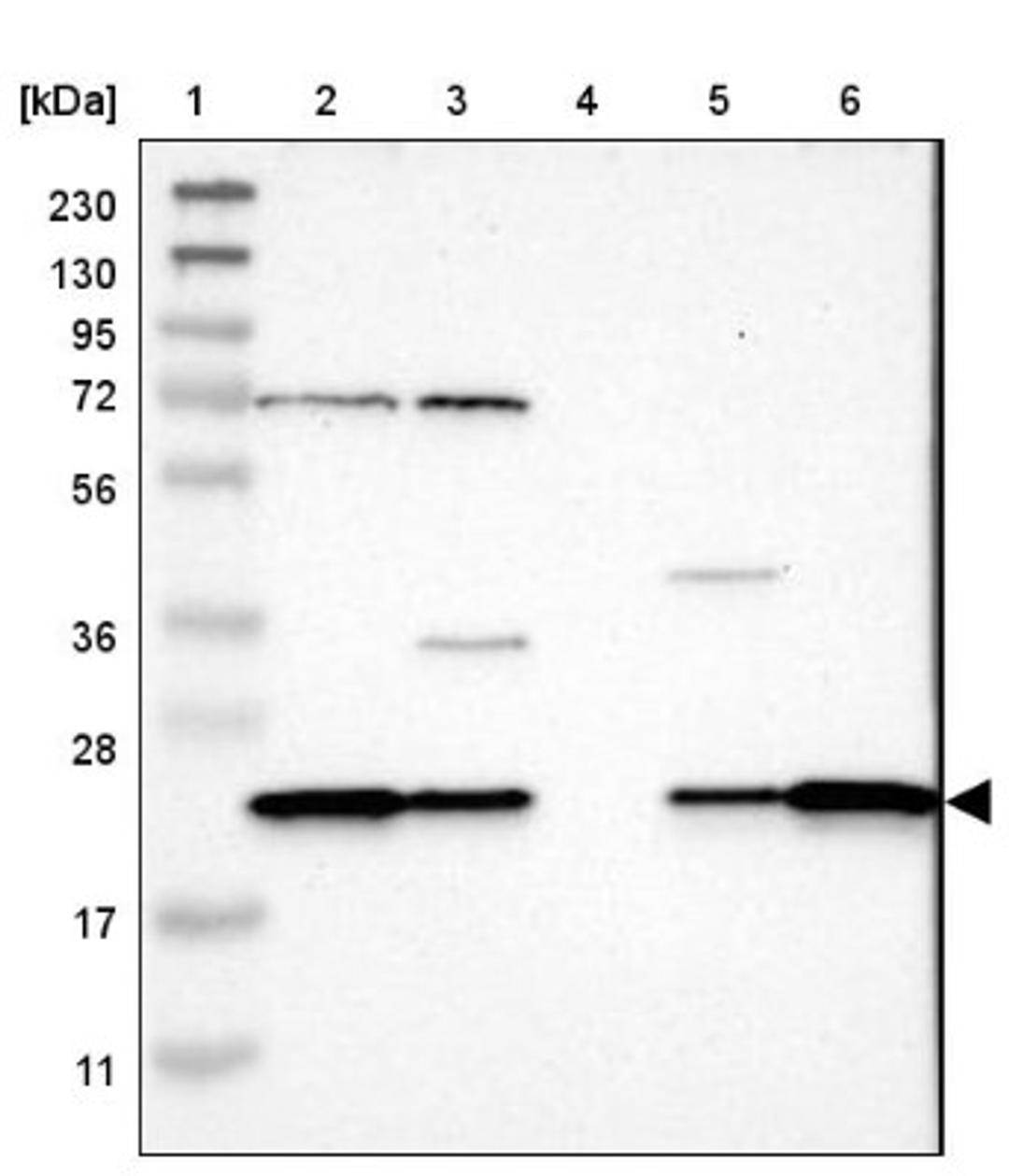 Western Blot: SPCS2 Antibody [NBP1-93656] - Lane 1: Marker [kDa] 230, 130, 95, 72, 56, 36, 28, 17, 11<br/>Lane 2: Human cell line RT-4<br/>Lane 3: Human cell line U-251MG sp<br/>Lane 4: Human plasma (IgG/HSA depleted)<br/>Lane 5: Human liver tissue<br/>Lane 6: Human tonsil tissue