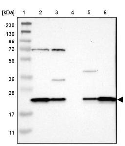 Western Blot: SPCS2 Antibody [NBP1-93656] - Lane 1: Marker [kDa] 230, 130, 95, 72, 56, 36, 28, 17, 11<br/>Lane 2: Human cell line RT-4<br/>Lane 3: Human cell line U-251MG sp<br/>Lane 4: Human plasma (IgG/HSA depleted)<br/>Lane 5: Human liver tissue<br/>Lane 6: Human tonsil tissue