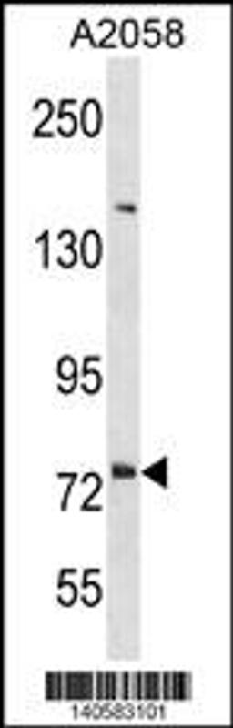 Western blot analysis in A2058 cell line lysates (35ug/lane).