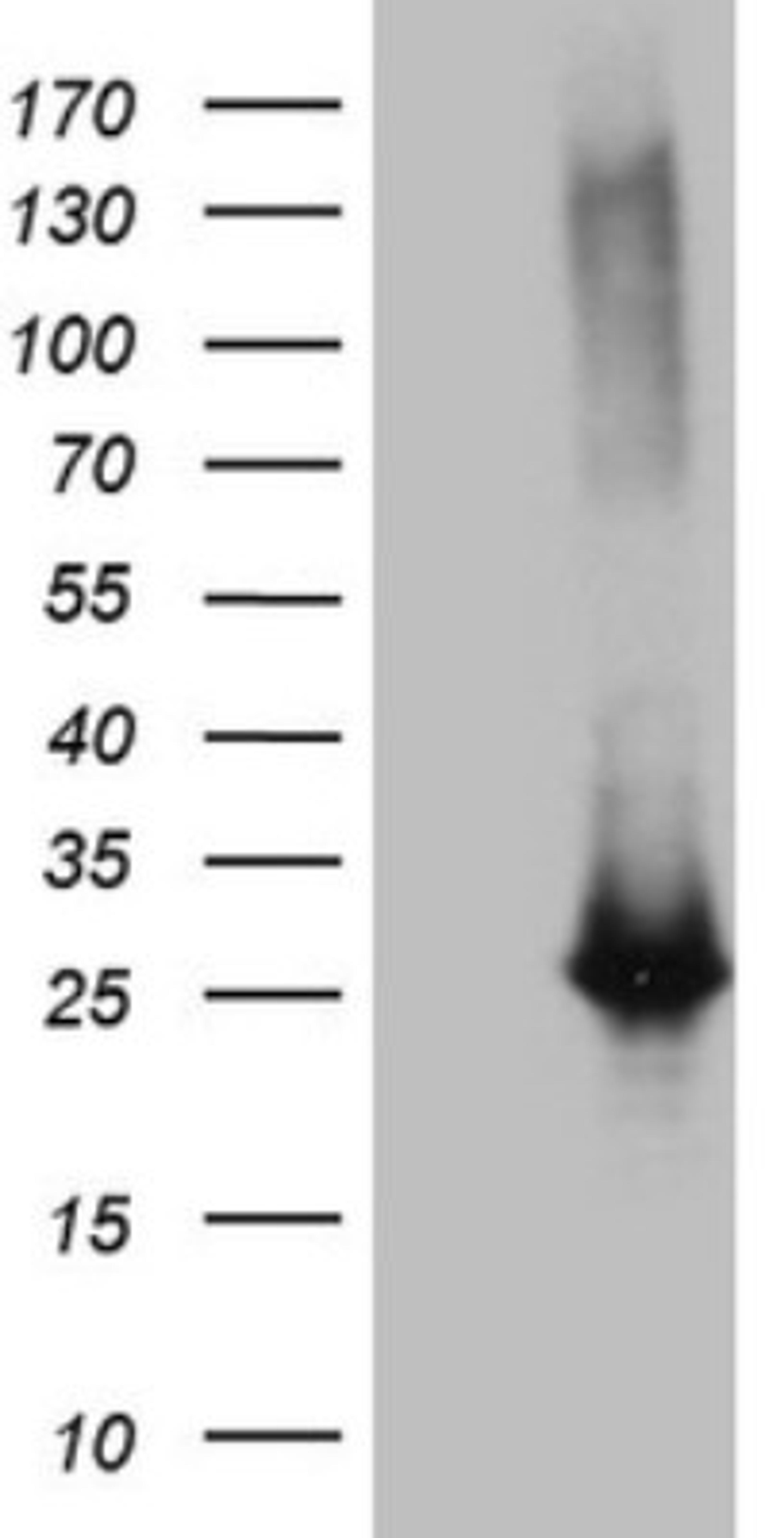 Western Blot: Exosome component 1 Antibody (1H9) [NBP2-45545] - Analysis of HEK293T cells were transfected with the pCMV6-ENTRY control (Left lane) or pCMV6-ENTRY Exosome component 1.