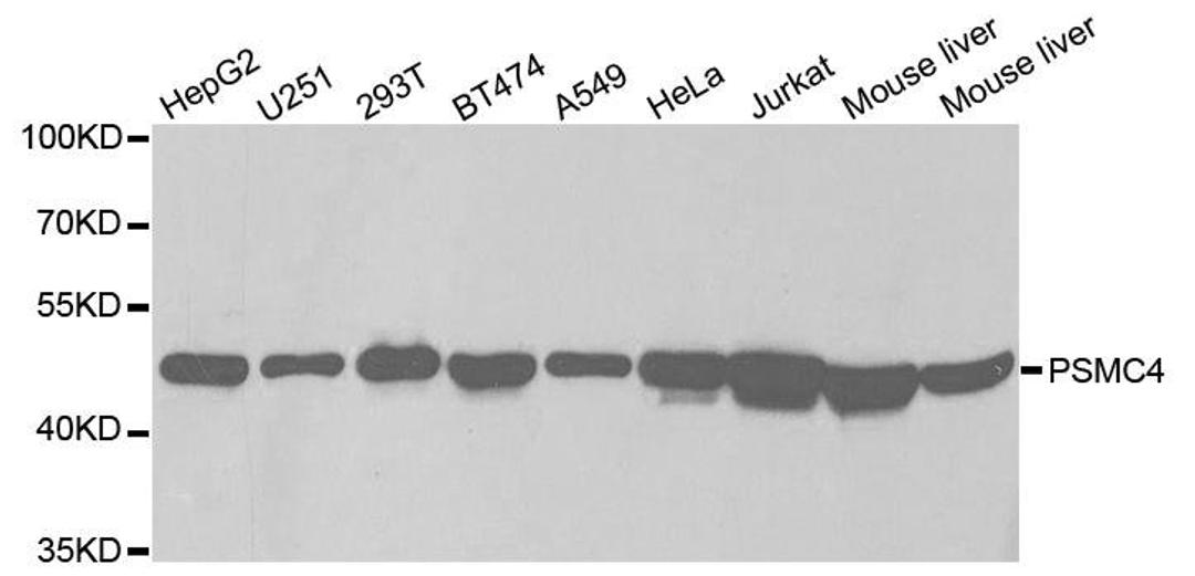 Western blot analysis of extracts of various cell lines using PSMC4 antibody