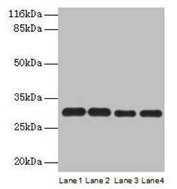 Western blot. All lanes: PMM1 antibody at 2µg/ml. Lane 1: HepG2 whole cell lysate. Lane 2: NIH/3T3 whole cell lysate. Lane 3: 293T whole cell lysate. Lane 4: Mouse brain tissue. Secondary. Goat polyclonal to rabbit IgG at 1/10000 dilution. Predicted band size: 30 kDa. Observed band size: 30 kDa