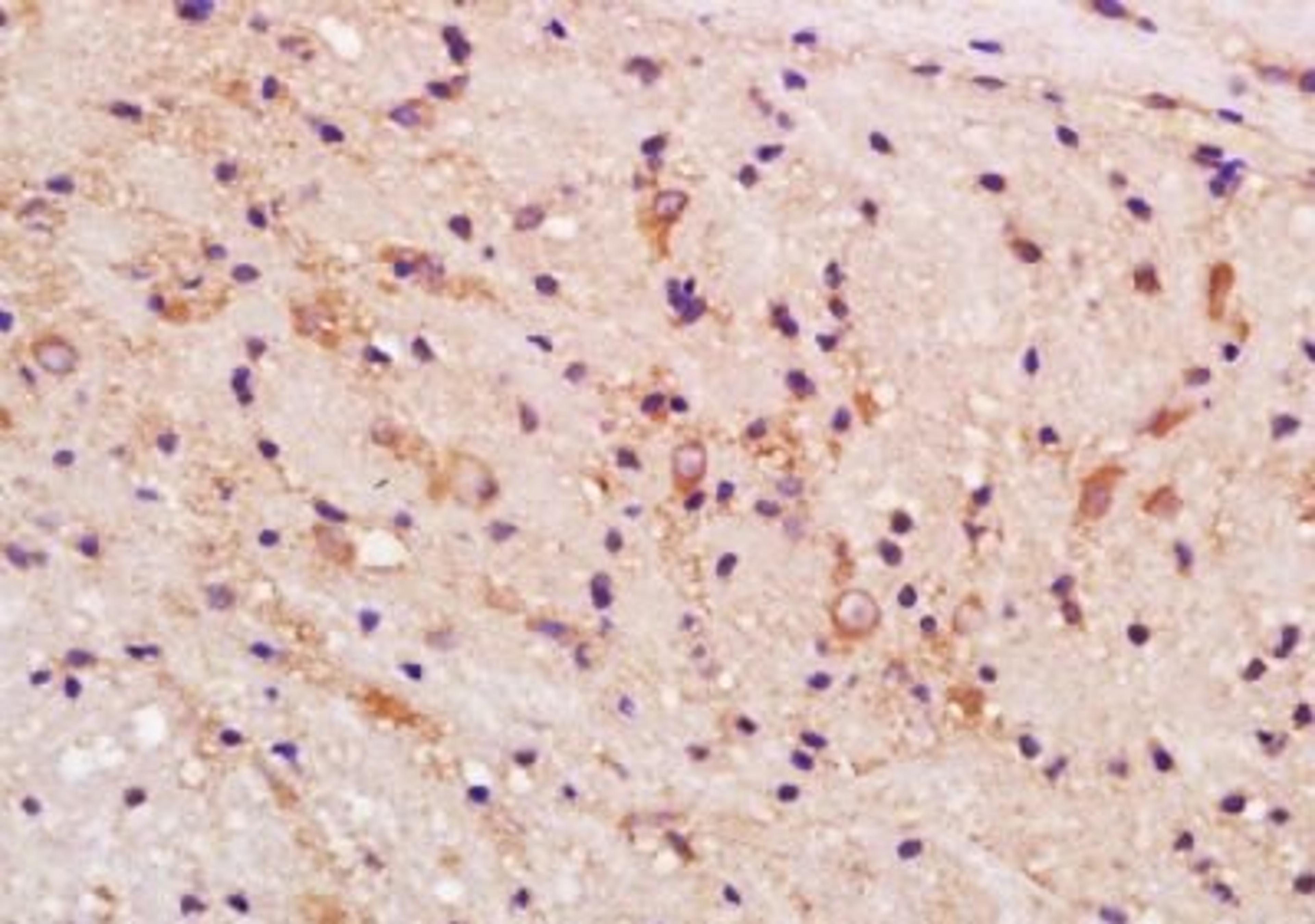 Immunohistochemical analysis of formalin-fixed paraffin embedded rat brain tissue using TRPM1 antibody (dilution at 1:200)