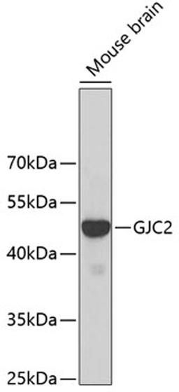 Western blot - GJC2 antibody (A2885)