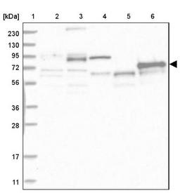 Western Blot: ABLIM2 Antibody [NBP1-81370] - Lane 1: Marker [kDa] 230, 130, 95, 72, 56, 36, 28, 17, 11<br/>Lane 2: Human cell line RT-4<br/>Lane 3: Human cell line U-251MG sp<br/>Lane 4: Human plasma (IgG/HSA depleted)<br/>Lane 5: Human liver tissue<br/>Lane 6: Human tonsil tissue