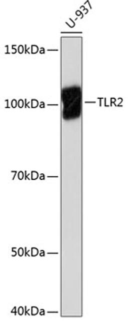 Western blot - TLR2 antibody (A19125)