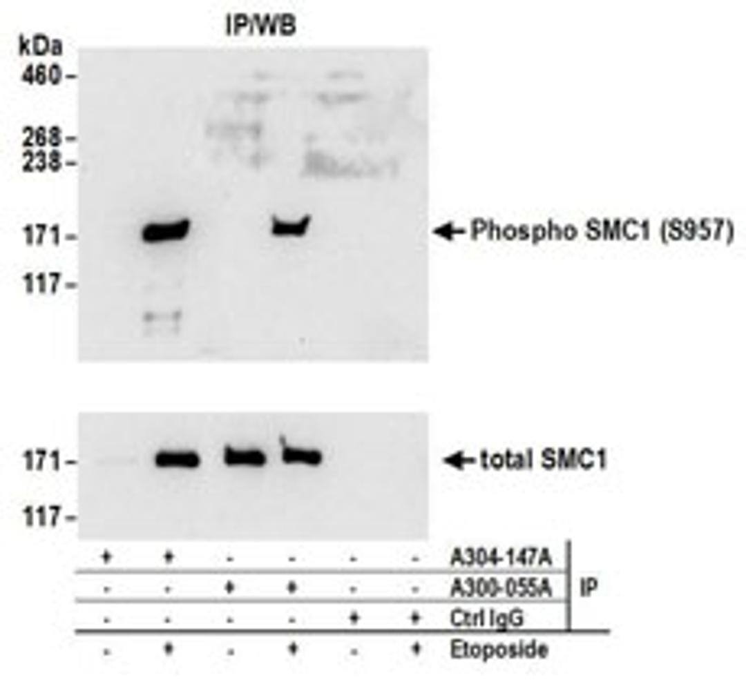 Detection of human Phospho SMC1 (S957) by western blot of immunoprecipitates.