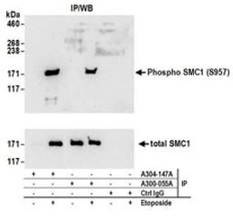 Detection of human Phospho SMC1 (S957) by western blot of immunoprecipitates.