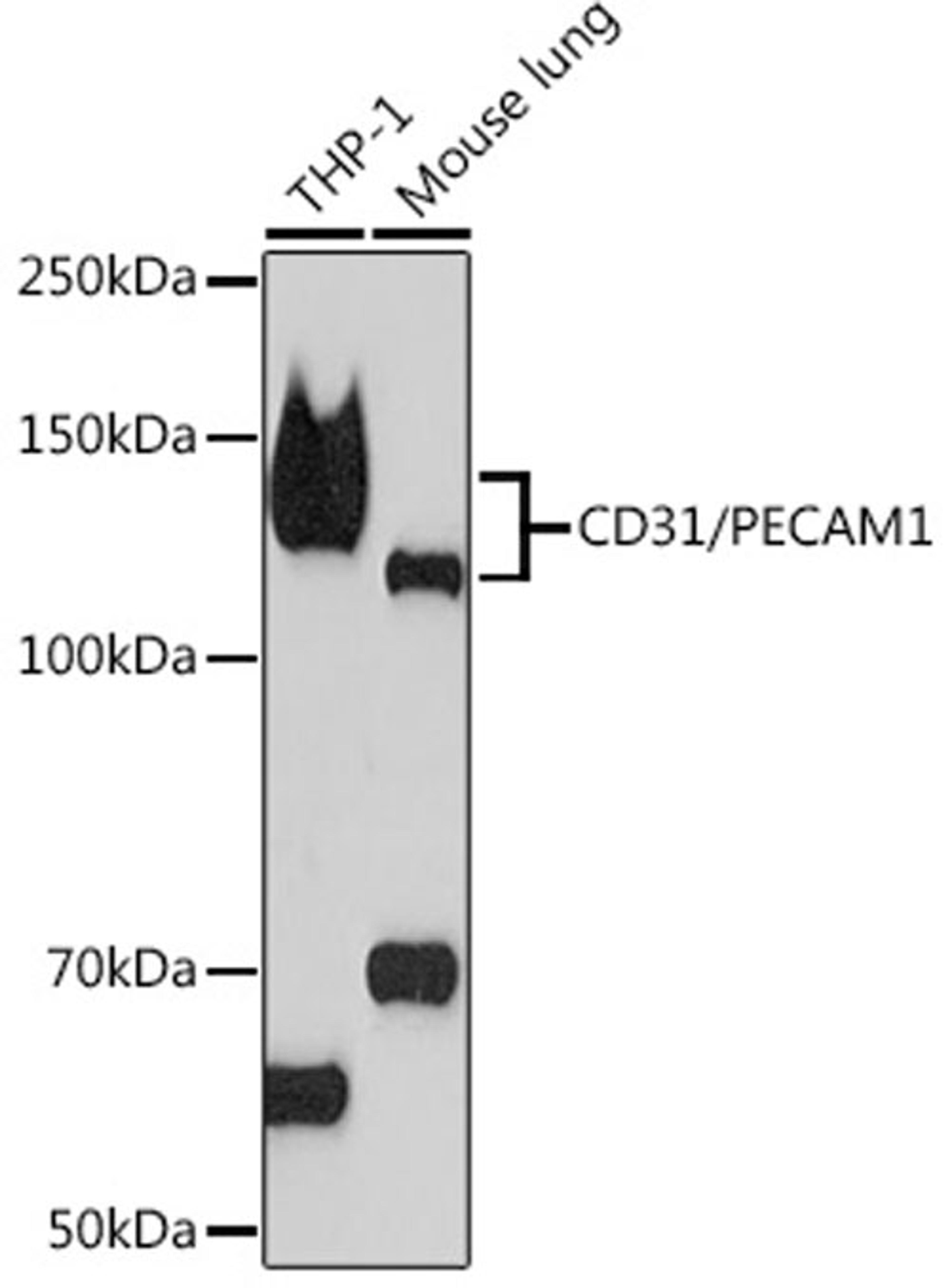 Western blot - CD31/PECAM1 Rabbit mAb (A4900)